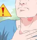 Get Rid of a Sore Throat
