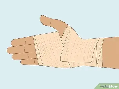 Image titled Apply Different Types of Bandages Step 17