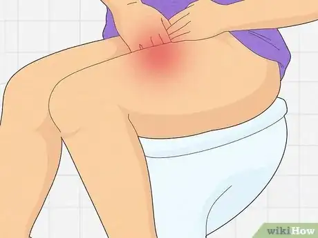 Image titled Diagnose a Yeast Infection at Home Step 7
