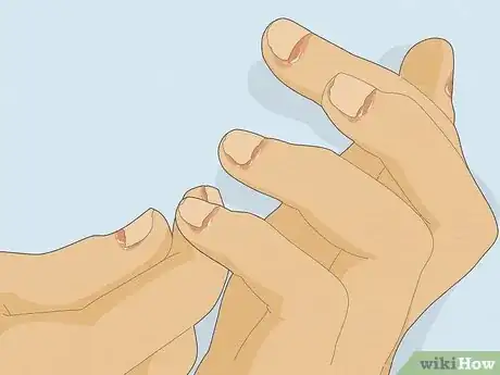 Image titled Stop Biting Your Fingers Step 12