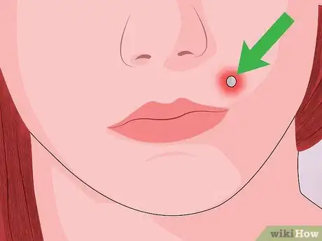 Image titled Take Care of a New Monroe Piercing Step 11
