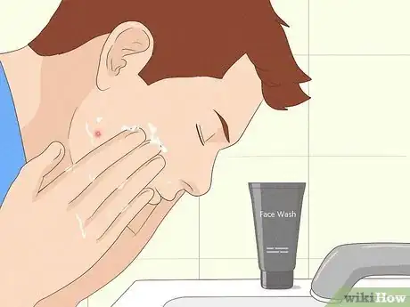 Image titled Instantly Get Rid of a Pimple (Cotton Ball Popping Method) Step 1