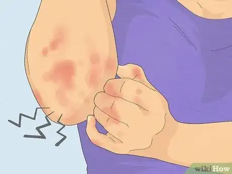 Image titled Diagnose a Yeast Infection at Home Step 9