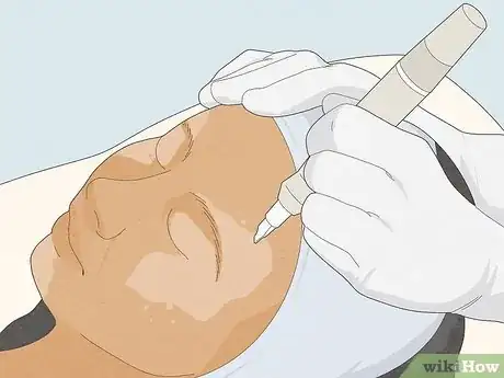 Image titled Cover Vitiligo Patches with Makeup Step 12