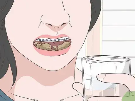 Image titled Eat Food With New or Tightened Braces Step 6