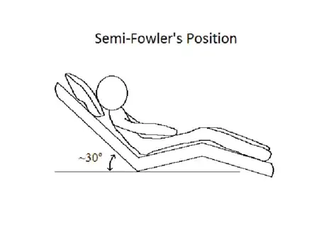 Image titled 3 semi Fowler's position.png