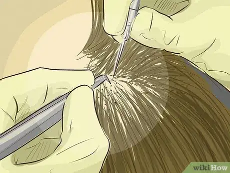Image titled Help Your Hair Grow Faster when You Have a Bald Spot Step 22