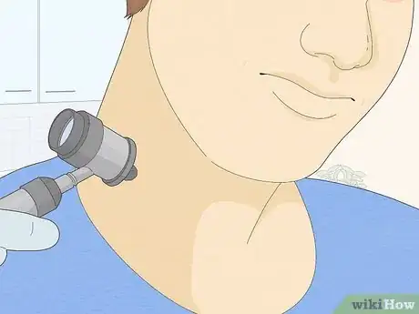 Image titled Remove a Mole with Iodine Step 4