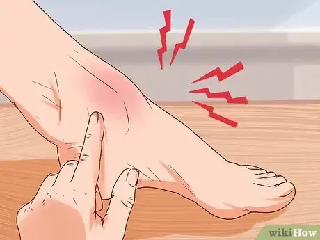 Image titled Check for a Fracture when Performing First Aid Step 3