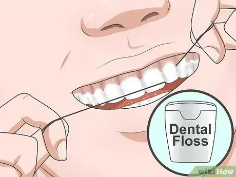 Image titled Reduce Gum Swelling Step 11