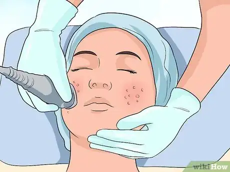 Image titled Get Rid of Large Pores and Blemishes Step 14