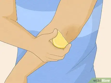 Image titled Clean Your Elbows Step 6