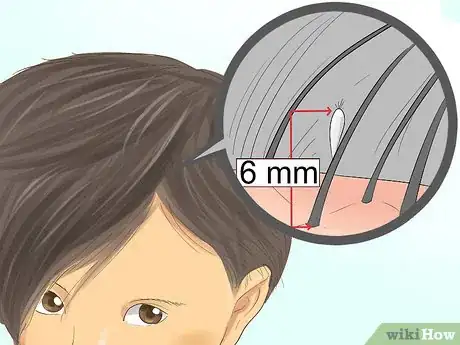 Image titled Check a Child's Hair for Lice Step 6