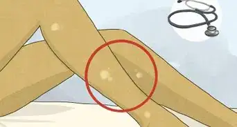 Avoid Itching After Waxing