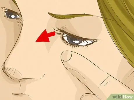 Image titled Get an Eyelash Out of Your Eye Step 5