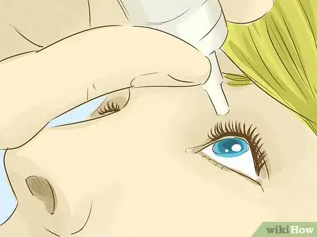 Image titled Get an Eyelash Out of Your Eye Step 3