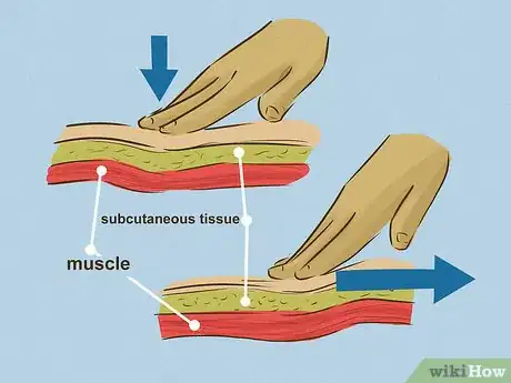 Image titled Give an Intramuscular Injection Step 15