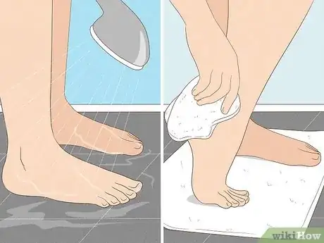 Image titled Treat Trench Foot Step 9