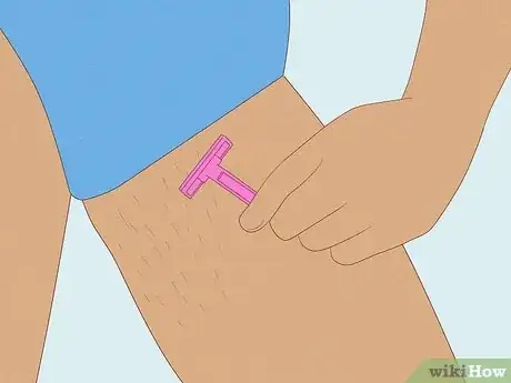 Image titled Get Rid of a Rash Between Your Legs Step 6