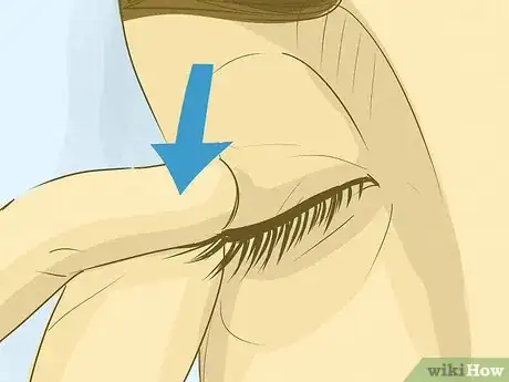 Image titled Get an Eyelash Out of Your Eye Step 9