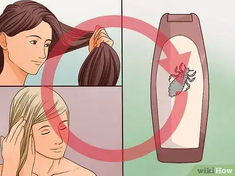Image titled Check for Lice Step 24