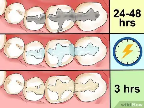 Image titled Care for a Tooth Filling Step 1