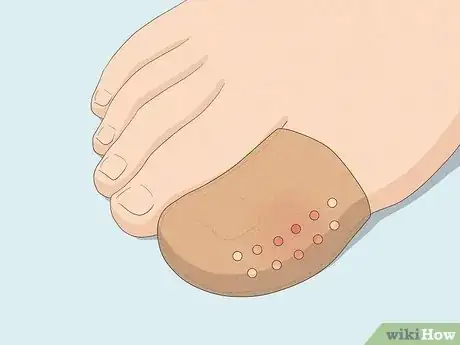 Image titled Protect Toenails when Running Step 4