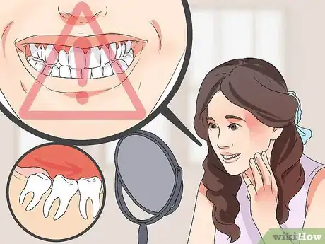 Image titled Tell if Your Wisdom Teeth Are Coming in Step 5