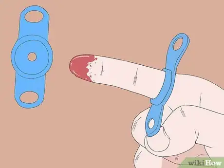 Image titled Stop a Cut Off Finger Tip from Bleeding Step 5