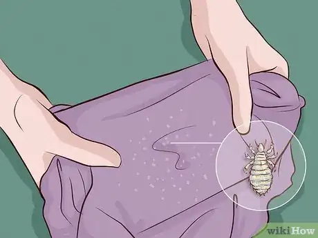Image titled Get Rid of Lice Step 2
