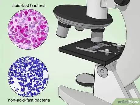 Image titled Identify Bacteria Step 22