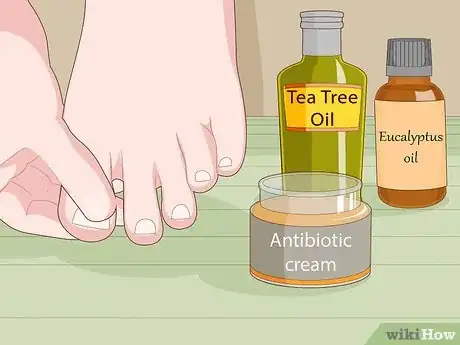 Image titled Prevent Ingrown Nails Step 11