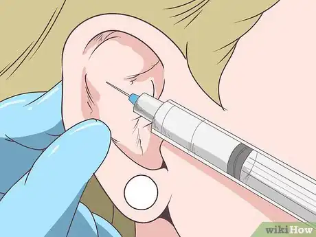 Image titled Prevent Cauliflower Ear Step 10