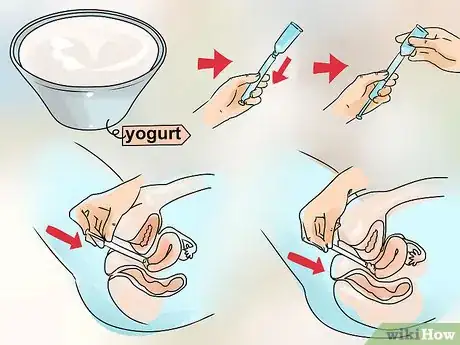 Image titled Cure Vaginal Infections Without Using Medications Step 19