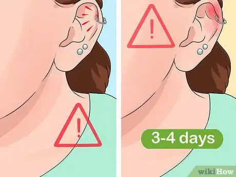 Image titled Clean a Cartilage Piercing Step 10