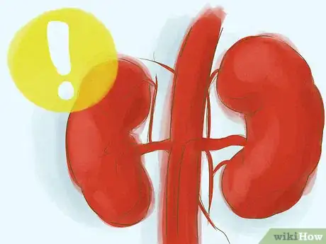 Image titled Improve Kidney Function Step 11