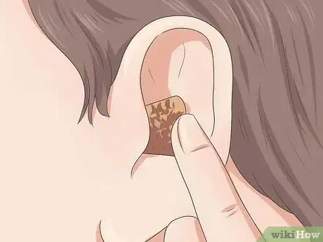 Image titled Pierce Your Own Tragus Step 7