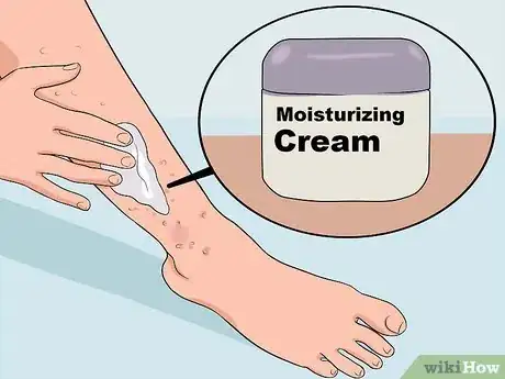 Image titled Get Rid of a Rash from Nair Step 4