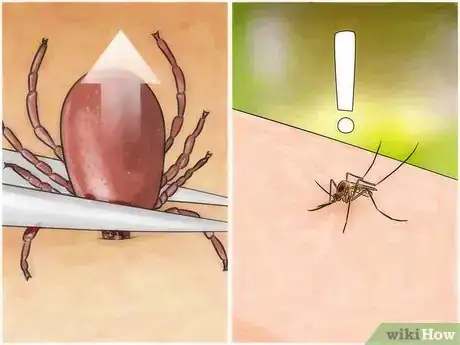 Image titled Get Bug Bites to Stop Itching Step 14