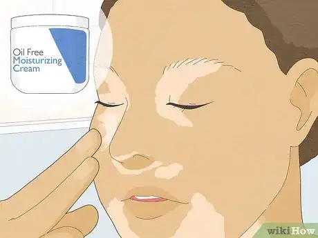 Image titled Cover Vitiligo Patches with Makeup Step 3