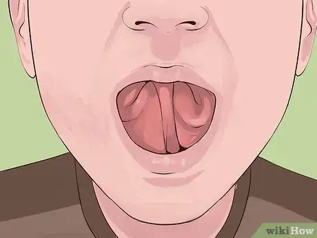 Image titled Roll Your Tongue Step 10