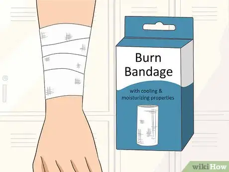 Image titled Prevent Burn Scars Step 3