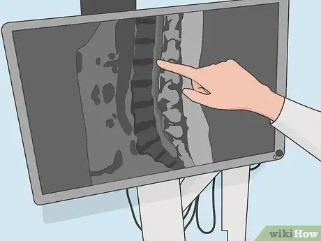 Image titled Read a Lumbar MRI Step 08