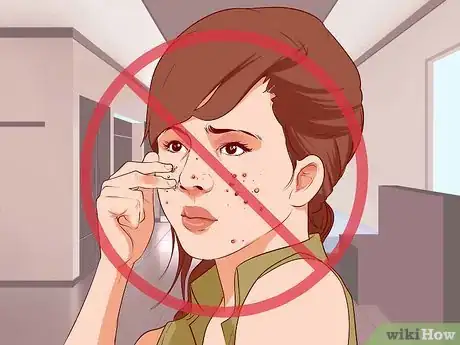 Image titled Reduce Acne Redness Quickly Step 1