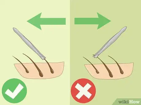 Image titled Avoid Bumps When Plucking Hair Step 6