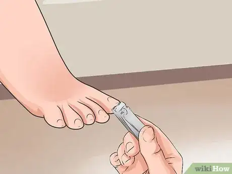 Image titled Avoid Ingrown Toenails Step 1