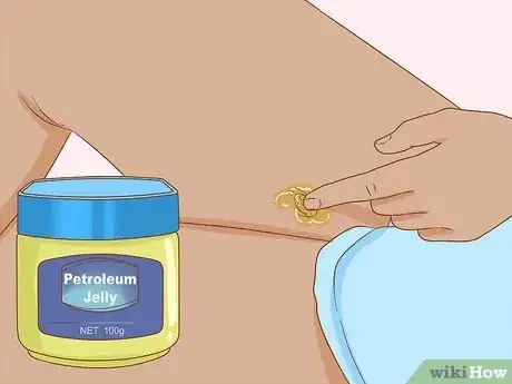 Image titled Get Rid of Boil Scars Step 13