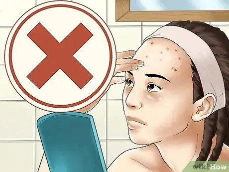 Image titled Get Rid of Forehead Acne Step 17