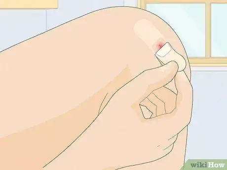 Image titled Remove a Band Aid Step 14