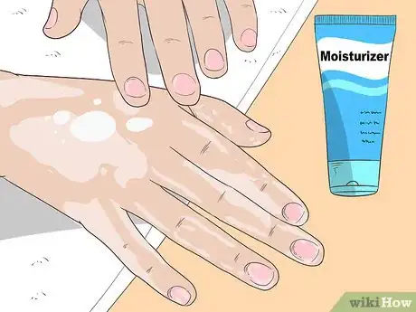 Image titled Get Rid of Psoriasis on Your Nails Step 13